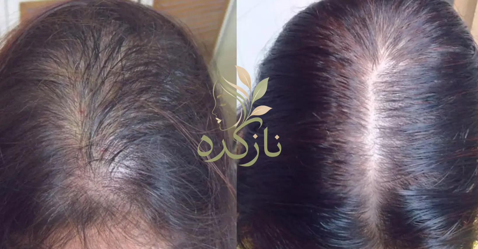 تصاویر کاربران از رضایت قرص پریورین