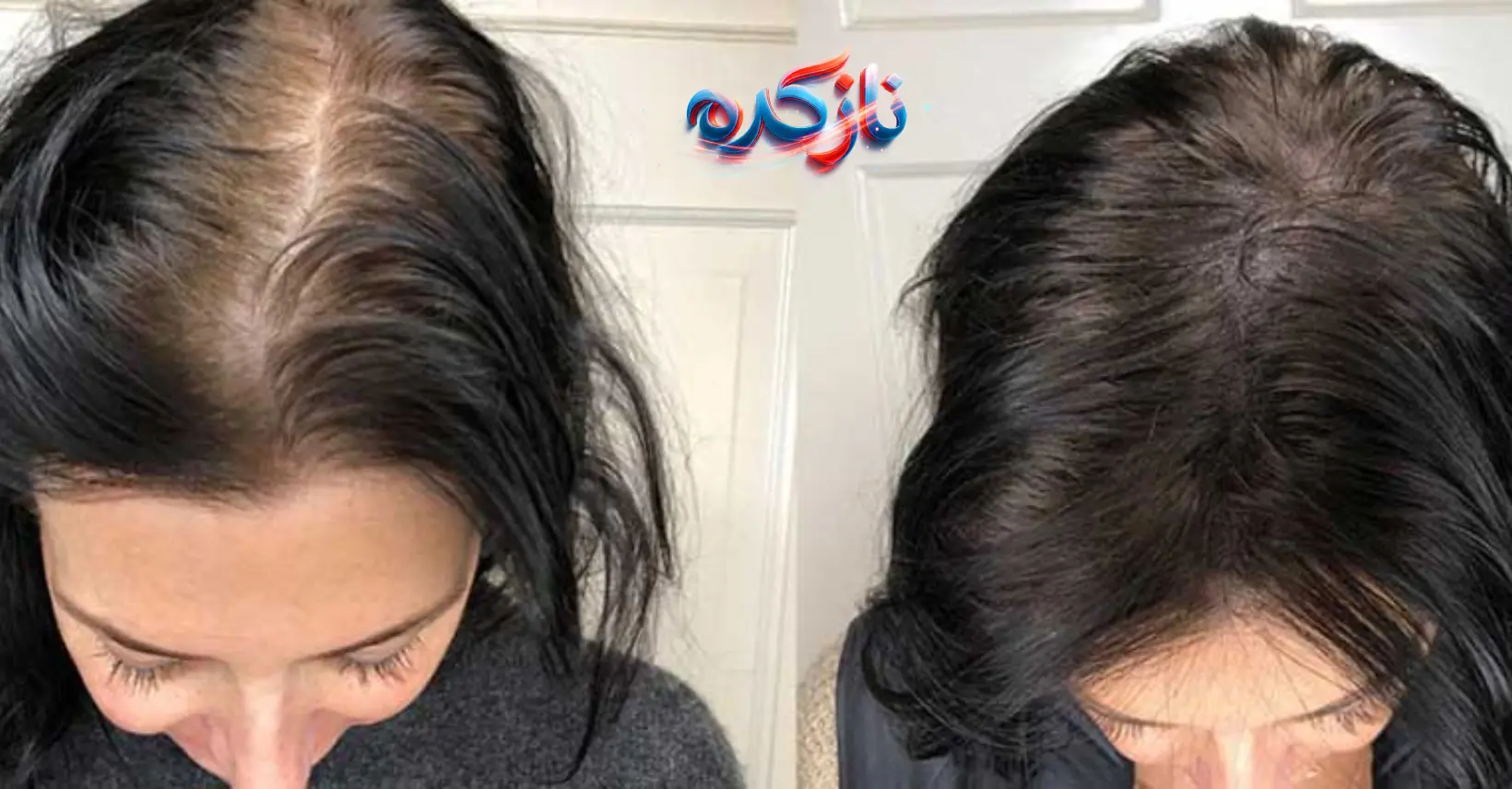 نتایج واقعی کاربران پس از مصرف قرص هیرتامین