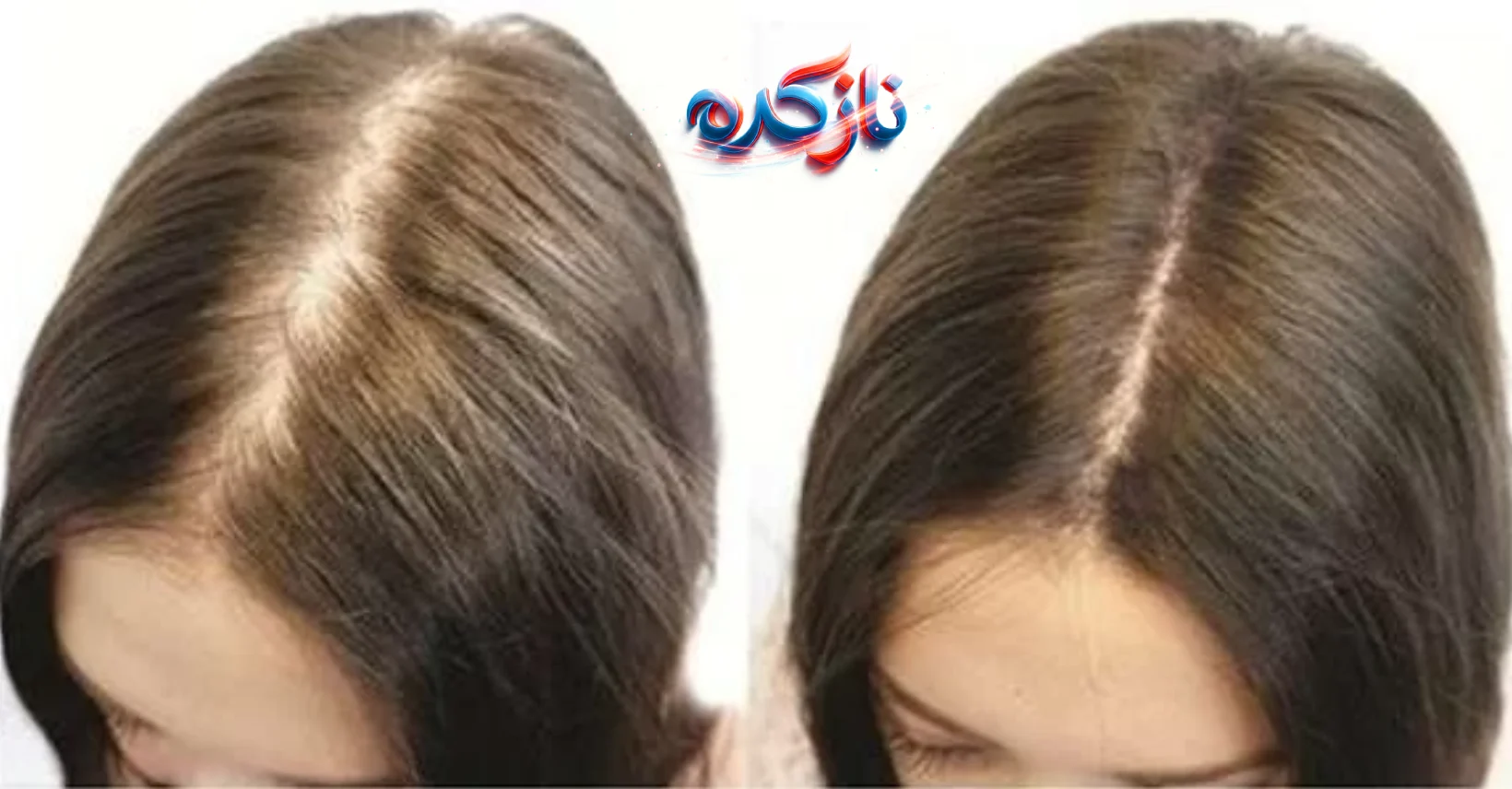 نتیجه استفاده از قرص هیرتامین