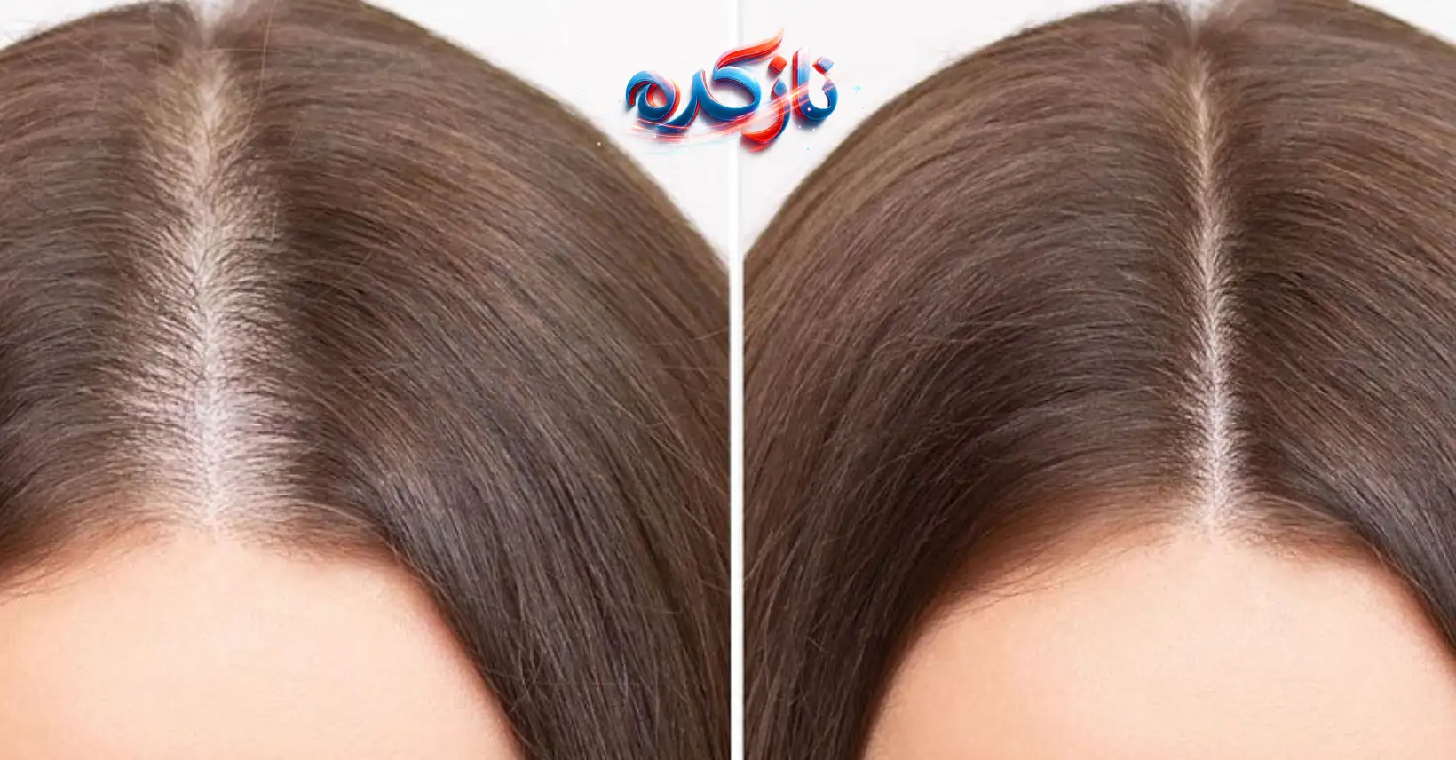 نتیجه مصرف قرص هیرتامین اورجینال