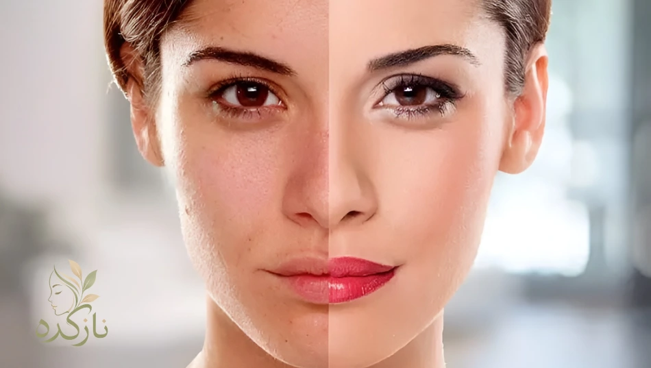 قرص ایمدین چیست و برای چه افرادی طراحی شده است؟