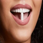 قرص رشد مو